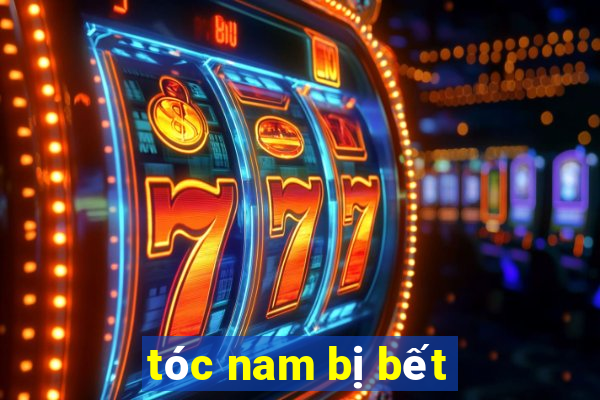 tóc nam bị bết